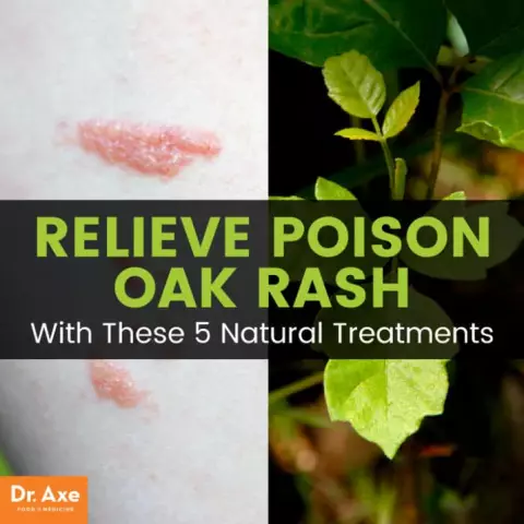 Poison Oak Rash & Canines