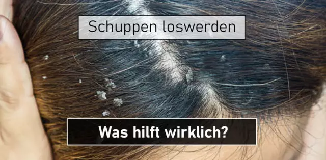 Tipps zum Entfernen von Hundehaar und Schuppen aus der Luft